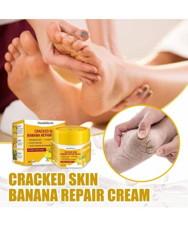 Anti-Dry Skin Foot Cream | Nourishing Moisturizer for Dry Feet - A Size | International Shipping Available - Buy Online on SooperMarket.com