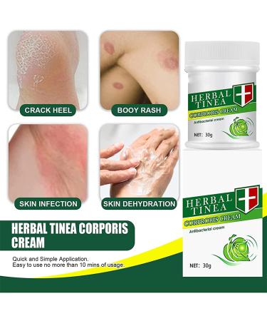 Organic Herbal Tinea Corporis & Psoriasis Cream Relief (3pcs) - Non-Irritating Eczema & Itching Treatment - 0.04 oz - Buy Online on SooperMarket.com