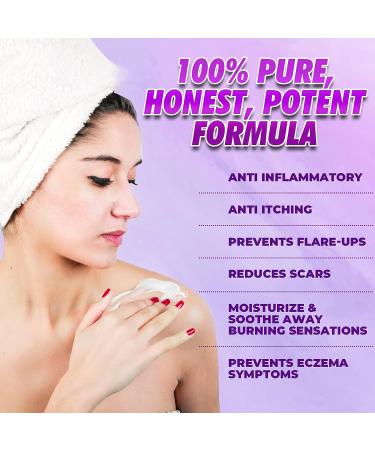 Natrulo Natural Eczema & Psoriasis Cream 2oz Gentle Itch Relief for Adults, Kids & Babies - Buy Online on SooperMarket.com