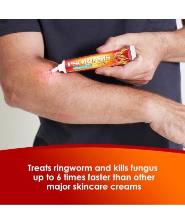 Itching Cream for Minor Irritations | Soothes and Restores Irritated Skin | Health Care for Men and Women - Buy Online on SooperMarket.com