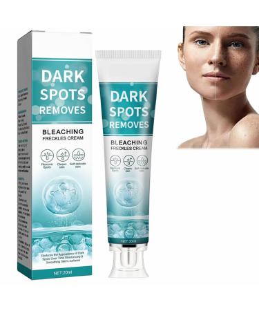 Fade Stain Beauty Cream Freckle Remover Cream Dark Spot Remover for Face Age Spot Remover Corrector Cream for Face and Body Dark Spot Remover Dark Spot Remover for Face and Body