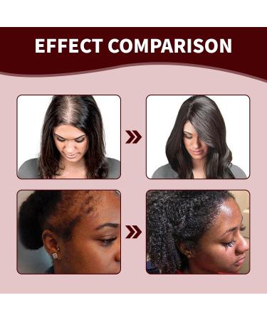 FunnAura Raw Batana Oil for Hair Growth Organic Batana Oil for Hair Growth Prevent Hair Loss for Men Women - Buy Online on SooperMarket.com