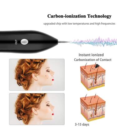CHRERNA Skin Tags & Mole Removal Kit - 9 Modes Plasma Pen for Warts, Spots, Body & Facial Nevus - Buy Online on SooperMarket.com