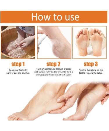 Tongyend Foot Peeling Spray Foot Callus Removal Spray Foot Peel Spray Instant Foot Peeling Spray Orange Oil Soften& Moisturize Peel-Off Spray for Cracked Rough Dry Skin Foot Care - Buy Online on SooperMarket.com