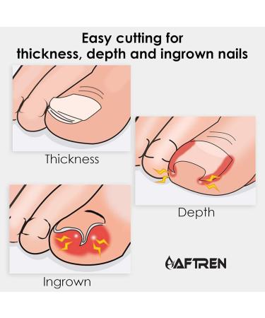 Professional Cuticle Nippers Precision Manicure Nail Clippers Stainless Steel Scissors Thick and Ingrown Nails Hospital Grade Podiatry Tool - Buy Online on SooperMarket.com
