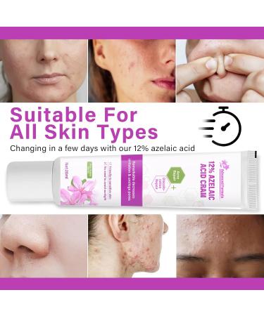 Azelaic Acid Serum Cream 12% Azelaic Acid Cream Redness Relief Face Balance Excess Sebum 20ml - Buy Online on SooperMarket.com