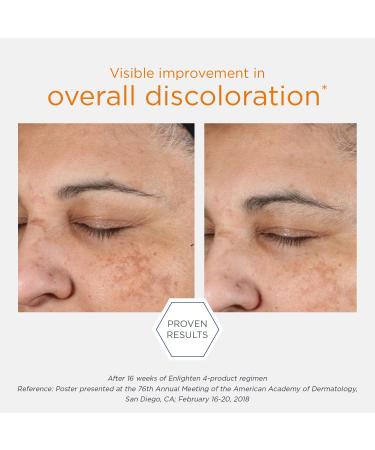 NEOSTRATA Pigment Controller Brightening Face Treatment with Retinol & Vitamin C | Oil-Free Moisturizer 1.7 fl oz - Pack of 1 - Buy Online on SooperMarket.com