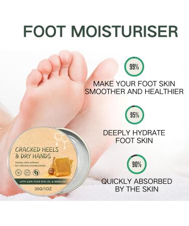 Foot Cream for Cracked Heels and Dry Skin Feet Hard Skin Remover Foot Moisturiser Callus Remover for Feet Nourishes Feet & Hand Foot Care Cream to Improve Elasticity & Smoothen Skin - Buy Online on SooperMarket.com