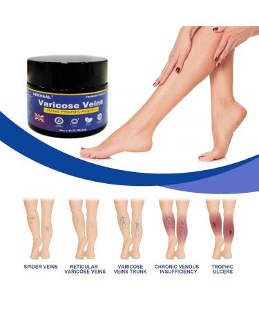 Varicose Veins Cream & Spider Veins Repair - Improve Blood Circulation & Soothe Itching - 1.76 OZ - Buy Online on SooperMarket.com