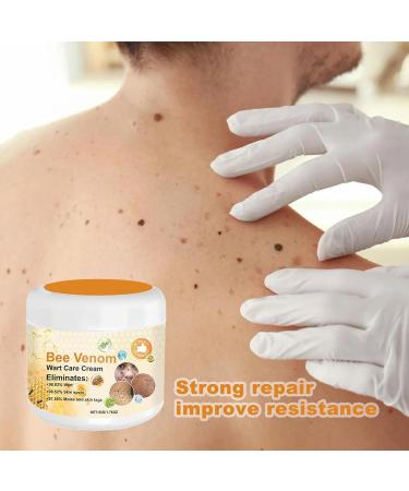 Bee Venoms Wart and Tag Remover Bee Venoms Tag Remover Bee Venoms Tag Removal Cream Tag Recede Bee Venoms Treatments Tag Recede Bee Venoms Cream for All Skin - Buy Online on SooperMarket.com
