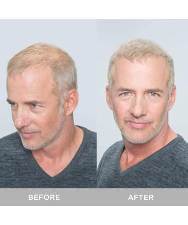 XFusion Keratin Hair Fibers in Medium Brown - Instantly Transform Thinning Hair - Buy Online on SooperMarket.com