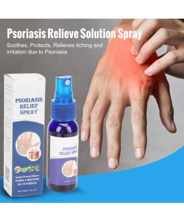 ZJchao 2pcs 30ml Psoriasis Relief Solution Spray - Effective Itch Relief Treatment for Skin, Hand, and Foot - Buy Online on SooperMarket.com