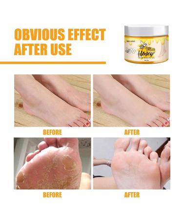 Yuci Banana & Honey-Milk Foot Balm - Repair Cracked Skin & Moisturize Dry Hands/Feet | Anti-Fungal Formula for Rough Skin - Buy Online on SooperMarket.com