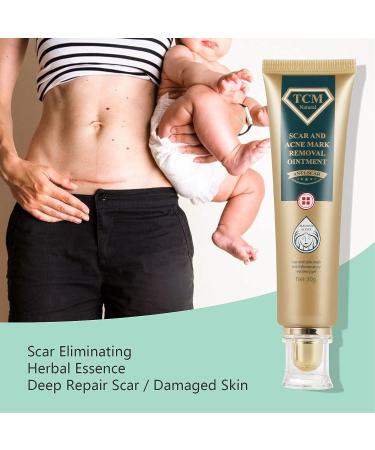 Silicone Scar Ointment 30g - Moisturizing Scar Cream for Smooth, Inconspicuous Scar Removal - Buy Online on SooperMarket.com