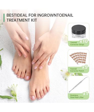 Ingrown Toenail Treatment Kit - 50 Pcs Patches, Corrector Strips, Nail Lifter | Professional & Painless Solution - Buy Online on SooperMarket.com