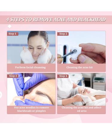 Blackhead Acne Removal Extractor Kit | Professional Stainless Pimple Blemish Tools with Storage Box - 4PCS - Buy Online on SooperMarket.com
