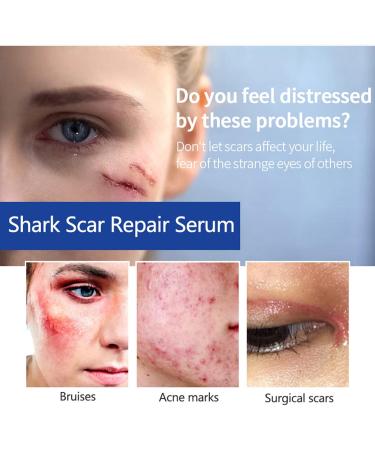 Shark Scar Repair Water 30ml - Moisturizing Scar Removal Liquid for Skin Repair | Color One Size - Buy Online on SooperMarket.com