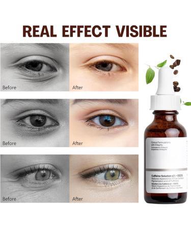 Caffeine Solution 5% + EGCG Eye Serum 30ml - Reduce Circles, Puffy Eyes, Wrinkles - Anti-Aging Eye Cream - Buy Online on SooperMarket.com