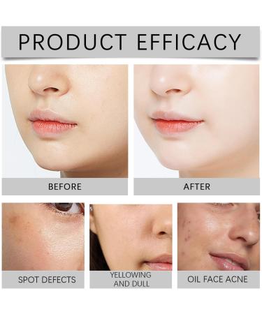 Lactic Acid 10% + HA Face Serum 10% Lactic Acid Serum Dark Spot Remover for Face Lactic Acid Face Moisturiser Pore Minimizer Hydrating Serum for Even Skin Tone Antioxidation Firming - Buy Online on SooperMarket.com