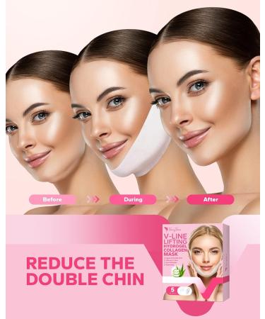 FairyFace V Line Shaping Face Masks - 5 Count Double Chin Reducer and Anti-Aging Hydrogel Collagen Mask with Aloe Vera and Seaweed - Anti-Wrinkle Lifting Treatment - Buy Online on SooperMarket.com