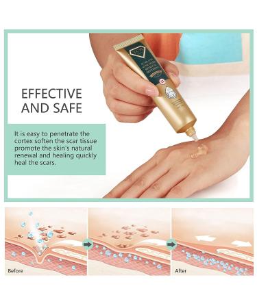 Silicone Scar Ointment 30g - Moisturizing Scar Cream for Smooth, Inconspicuous Scar Removal - Buy Online on SooperMarket.com
