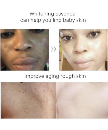 FAYNDE Turricum Body Cream 100ml - Nourishing Daily Skin Care with Ginger Extract for Women & Teens | Ideal for Back Neck Shoulders Arms & Legs - Buy Online on SooperMarket.com