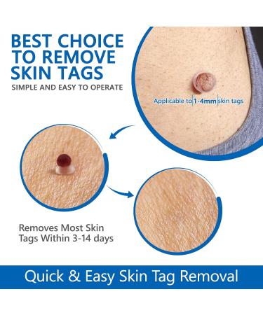 Acrochordon Treatment Kit Anti-Tick Treatment with 60 Strips of Micro and Regular Skin Labels (1mm to 9mm) for Face and Body with 36 Repair Patches - Buy Online on SooperMarket.com