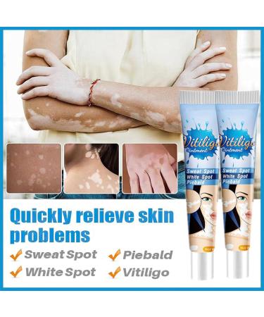 MIELIKKI Vitiligo Cream | Reduce White Spots & Enhance Skin Pigmentation | Natural Vitiligo Care Cream for All Skin Types - Buy Online on SooperMarket.com