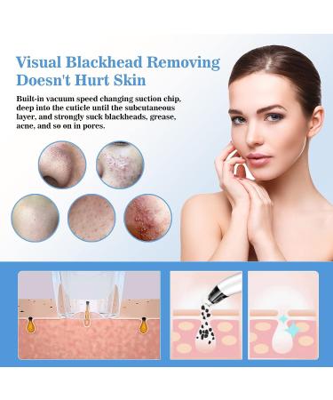 Hohotti Blackhead Remover Vacuum with Camera | USB Rechargeable Pore Vacuum for Face | 6 Suction Heads & 5 Modes | Acne Extractor Tool Kit - Buy Online on SooperMarket.com