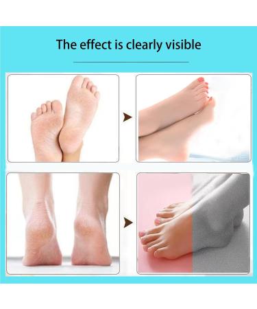 Smooth Pedicure Wand - Electric Rechargeable Callus Remover & Foot Care Kit for Smoother Feet - Buy Online on SooperMarket.com