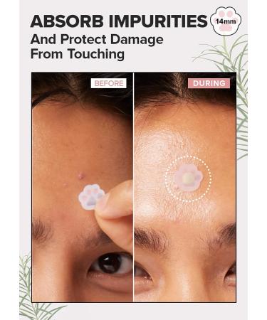 I DEW CARE Hydrocolloid Acne Pimple Patch - 36 Count with Tea Tree Oil | Happy Paws Blemish Patch for Mother's Day - Buy Online on SooperMarket.com