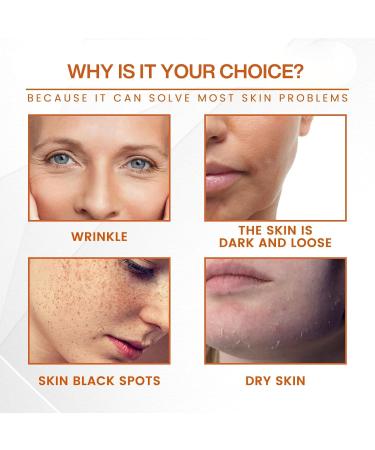 Vitamin C Face Mist Vitamin C Serum Spray For Face Anti Aging Face Spray Face Serum Lifting & Firming Mask And Spray Hydrating Mist Deeply Moisturizing & Skin Brightening Spray - Buy Online on SooperMarket.com