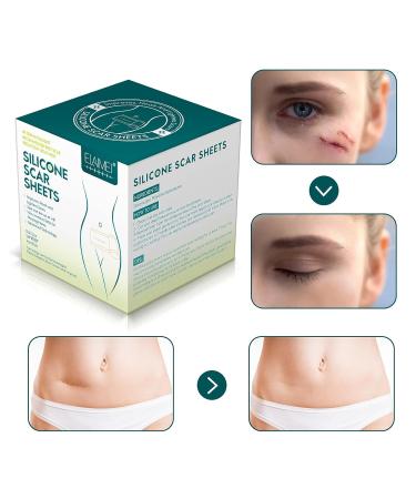 Keloid Bump Removal Silicone Gel Scar Remover Pen - Clear Outdoor Man Skin Care - One Size - Buy Online on SooperMarket.com