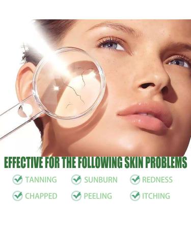 Skin Recovery Cream - Aloe After Sun Repair 100g (2pcs) | Hydrating Nourishing Lightweight Formula for Sunburn Relief & Dull Skin Repair - Buy Online on SooperMarket.com