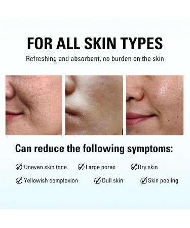 Kojic Acid Toner for Face - Face Toner Dark Spot Remover for Face Acne Toner Hydrating Toning Solution Even Skin Tone Korean Toner Skincare Exfoliating Toner for All Skin 118ml - Buy Online on SooperMarket.com