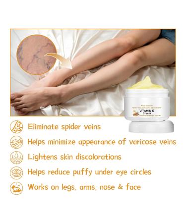 Vitamin K Cream for Varicose Veins - Miracle Cream for Spider Veins & Leg Vein Removal (1pcs) - Fast International Shipping - Buy Online on SooperMarket.com