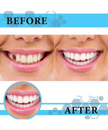 100 Pieces Resin Teeth Veneers for Halloween Cosplay, Scary Theme Party Makeup - Dental Temporary Front and Molar Posterior Teeth for Costume Filling - Buy Online on SooperMarket.com