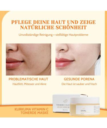 Face Mask - Turmeric Vitamin C Mask - Clay Mask Face for Cleanses Acne and Dark Spots Pores Reducing Face Masks Beauty 120 g - Buy Online on SooperMarket.com