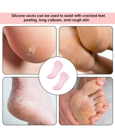 Silicone Moisture Socks for Dry Cracked Feet | Spa Gel Foot Masks - Anti-Slip Foot Care - Pink - Buy Online on SooperMarket.com