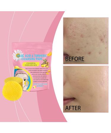 Turmeric Kojic Acid Cleansing Pads - 80 Exfoliating Face Pads for Brightening & Cleansing | International Shipping Available - Buy Online on SooperMarket.com