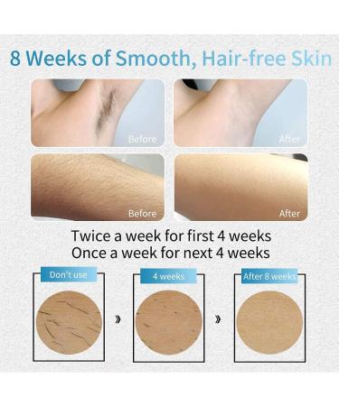 VEME IPL Hair Removal Device for Women - Permanent, Painless Hair Remover with 5 Energy Levels - 500,000 Flashes - Blue & White - Buy Online on SooperMarket.com