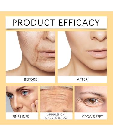 Shop Bee Venom Cream - New Zealand Moisturizer with Peptides & Coffea Arabica - Anti-Aging Hydrating Firming Collagen Booster - Buy Online on SooperMarket.com