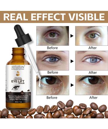 Caffeine Eye Serum Anti Aging Serum with EGCG Hyaluronic Acid Under Eye Cream for Dark Circles and Puffy Eyes Caffeine Eye Lift Serum Fade Fine Line Firming Eye Skincare 30ml - Buy Online on SooperMarket.com
