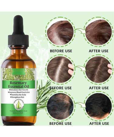 Rosemary Hair Oil(60ml) Rosemary Oil for Hair Growth Diluted Rosemary Essential Oils for Hair Loss & Skin Care Strengthens Hair Nourishes Scalp Hair Loss Improve Oil for Women and Men - Buy Online on SooperMarket.com