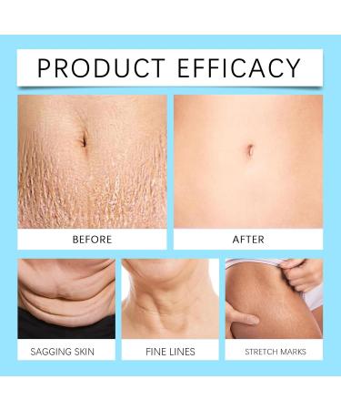 Skin Firming Cream Body Firming Cream for Loose Skin Skin Tightening Cream for Stomach Belly Firming Cream for Women&Men Skin Firming Lotion for Cellulite and Stretch Marks Lifting Moisturizing - Buy Online on SooperMarket.com