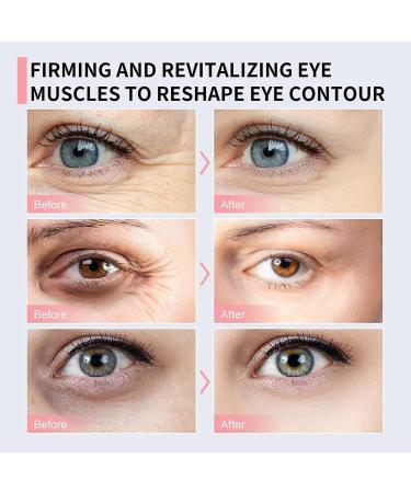 Retinol Stick Retinol Eye Cream for Dark Circles Under Eye Cream Anti Aging Anti Wrinkle Eye Cream Firming Eye Balm Stick Repairing Eye Skin Tightening Fade Fine Line Smooth Tender - Buy Online on SooperMarket.com