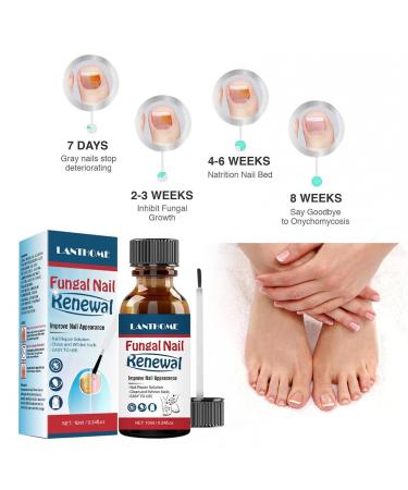 Nail & Cuticle Repair Oil - Promotes Growth & Regeneration for Natural & Acrylic Nails - 1 Piece (Brown) - International Shipping - Buy Online on SooperMarket.com