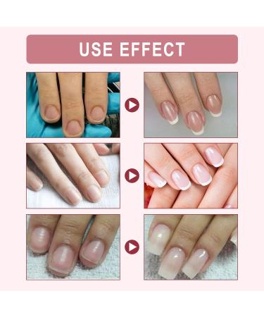Instant Nail Repair Gel - Nail Strengthener and Hardener for Broken Nails - 8ml - Buy Online on SooperMarket.com