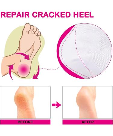 XAENA 3P Moisturizing Gel Heel Socks | Cracked Heel Repair Socks for Women | Toeless Gel Socks (White) - Shop Now! - Buy Online on SooperMarket.com