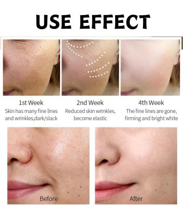Trendyfave Black Honey Serum Facial Brightening Serum Face Moisturiser Dark Spot Corrector Hydrating Serum Face Serum for Women & Men Face Serum With Honey Extract Serum for Face Care - Buy Online on SooperMarket.com